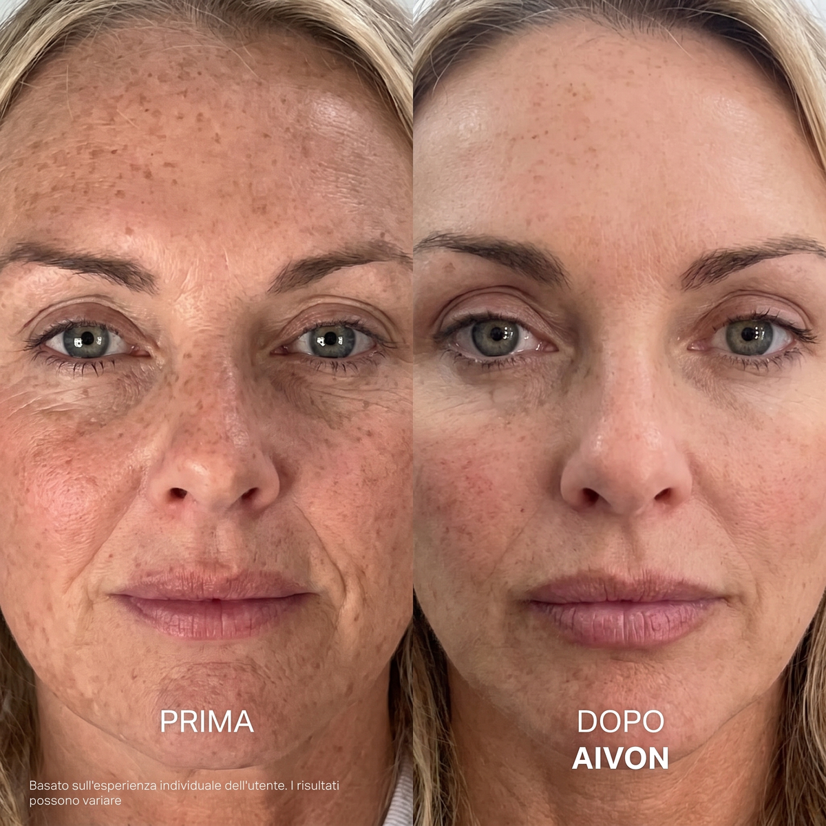 Aivon – Siero Coreano Effetto Lifting dalla Prima Applicazione