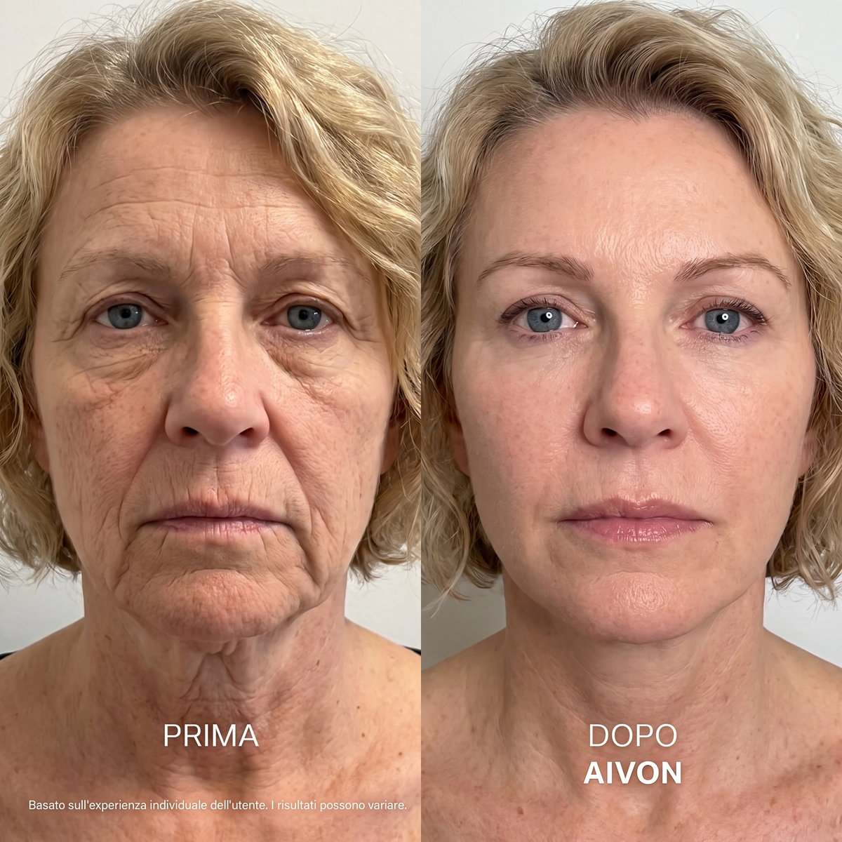 Aivon – Siero Coreano Effetto Lifting dalla Prima Applicazione
