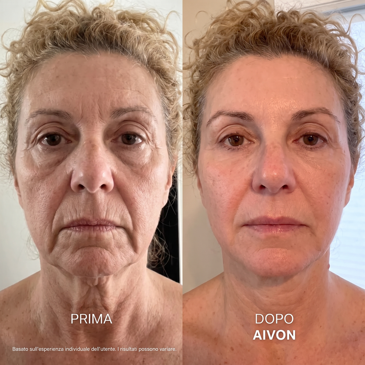 Aivon – Siero Coreano Effetto Lifting dalla Prima Applicazione